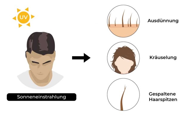 UV-Licht wird zu Haarersatz Haarausfall führen