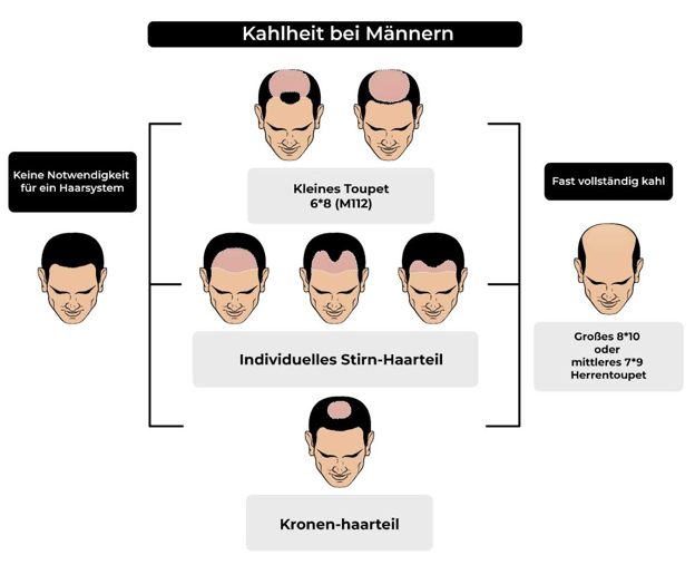 kahlheit bei männern