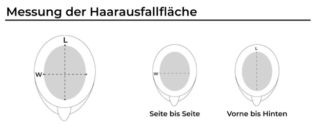 Messung der Haarausfallfläche