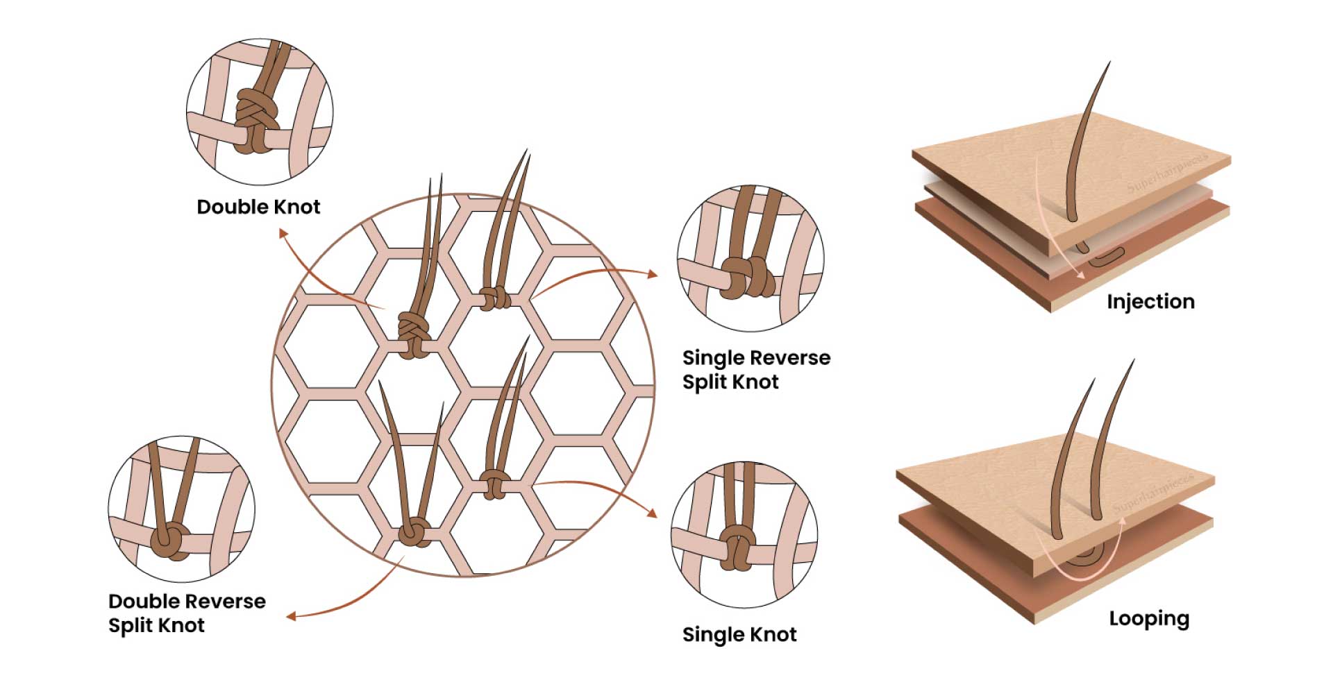 Haarsystem Kosten Knot